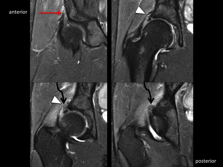 Figure 3 for case rectus femoris muscle ( RID2698 )